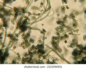 Photo Of Fungi Hyphae With Spores Under The Microscope