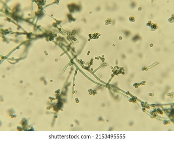 Photo Of Fungi Hyphae With Spores Under The Microscope