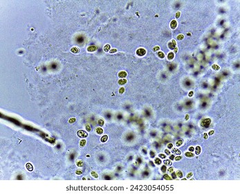 photo of fungi mold and yeasts under the microscope