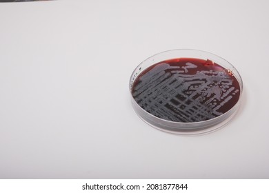 photo of growth of bacteria on blood agar