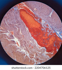 Photo Of Heart Muscle Tissue Under The Microscope