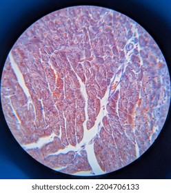 Photo Of Heart Muscle Tissue Under The Microscope