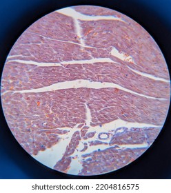 Photo Of Heart Muscle Tissue Under The Microscope