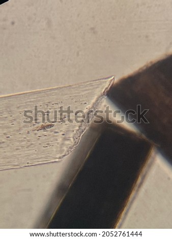 photo of human hair under microscope