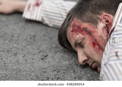 Photo Of Injured Man With Head Wound After Car Accident