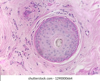 Photo From A Microscope Of A Tissue Section Of An Hair Follicle In A Histology Slide,testing For Alopecia Diseases,stained With Periodic Acid Shiff (PAS)showing  Blue Purple Nucleus And Pink Cytoplasm