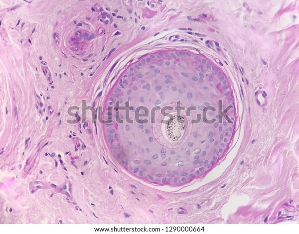 Photo from a microscope of a tissue section of\
an hair follicle in a Histology slide,testing for alopecia\
diseases,stained with periodic acid shiff (PAS)showing  blue purple\
nucleus and pink\
cytoplasm