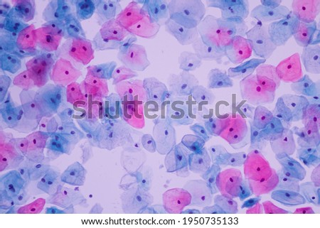 Photo of normal squamous epithelial cells of cervical human view in microscopy.Cytology criteria from pap smear.Medical background concept.