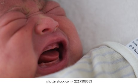 A Photo On The Left Side Showing A Close-up Of The Expression Of A Crying 0-year-old Newborn 1 Month After Birth