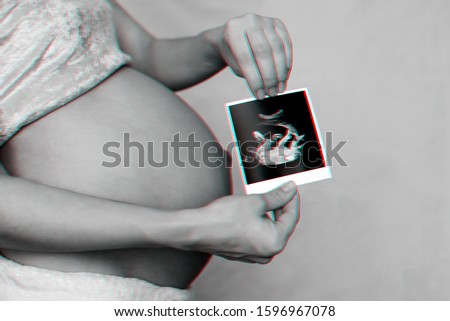 photo of a pregnant ultrasound in the hands of a pregnant girl on the background of the abdomen. Monochrome photography with 3D glitch effect