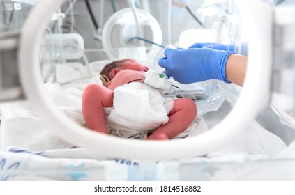 Photo of a premature baby in incubator. Focus is on his feet. Nurse in blue gloves is using the feeding tube for feeding premature baby. Neonatal intensive care unit - Shutterstock ID 1814516882