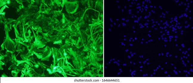 Photo of a pure astrocytes culture (brain glial cells) marked with antibodies for GFAP (green) + DAPI (blue) for nuclei