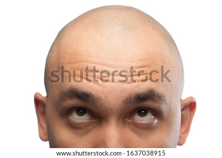 Photo of shaved man looking up, half head