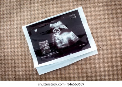 Photo Of An Ultrasound Sonogram Of An Unborn Baby