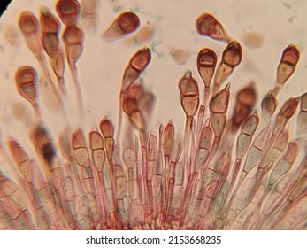 photo under microscope of fungi growth on the plant cells