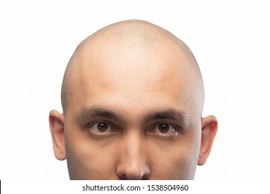 はげ の画像 写真素材 ベクター画像 Shutterstock