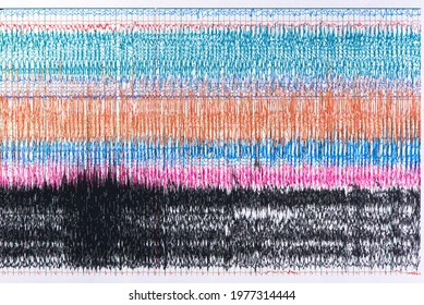 Photograph of brain waves during seizure.or ictal EEG  Seizure waves showing high amplitudes and high frequency. - Shutterstock ID 1977314444