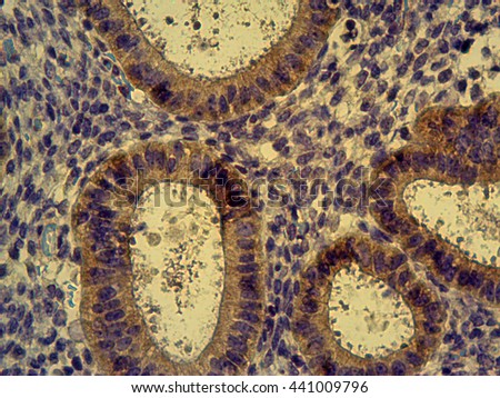 Photomicrograph of cross-section of human endometrial tissue showing glands in the endometrium stained immunohistochemically for epidermal growth factor receptor (EGFR) (brown), 40x magnification.