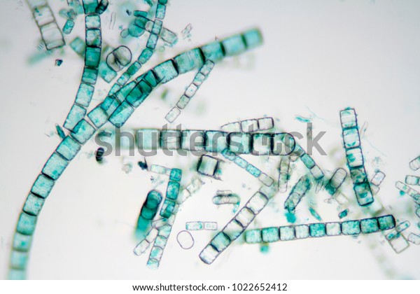 Photomicrograph of diatoms. Used in teaching\
aquatic\
biology.