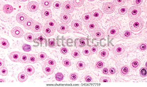 Photomicrograph of the human\
scalp, showing histology of hair follicles, cut as a tangential\
cross section. \
