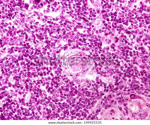 Photomicrograph Medulla Thymic Lobule Showing Corpuscle Stock Photo ...