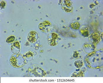 A Photomicrograph Of A Plant Protoplast Cell Isolated For Use In A Recent Cutting-edge Biotechnology CRISPR Technology Experiment.