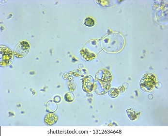 A Photomicrograph Of A Plant Protoplast Cell Isolated For Use In A Recent Cutting-edge Biotechnology CRISPR Technology Experiment.