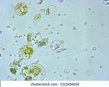 A Photomicrograph Of A Plant Protoplast Cell Isolated For Use In A Recent Cutting-edge Biotechnology CRISPR Technology Experiment.