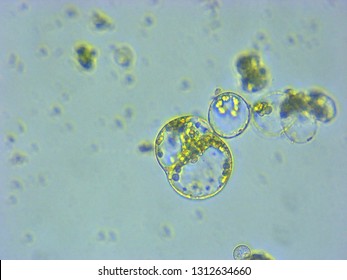 A Photomicrograph Of A Plant Protoplast Cell Isolated For Use In A Recent Cutting-edge Biotechnology CRISPR Technology Experiment.