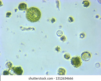 A Photomicrograph Of A Plant Protoplast Cell Isolated For Use In A Recent Cutting-edge Biotechnology CRISPR Technology Experiment.