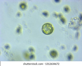 A Photomicrograph Of A Plant Protoplast Cell Isolated For Use In A Recent Cutting-edge Biotechnology CRISPR Technology Experiment.