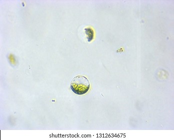 A Photomicrograph Of A Plant Protoplast Cell Isolated For Use In A Recent Cutting-edge Biotechnology CRISPR Technology Experiment.