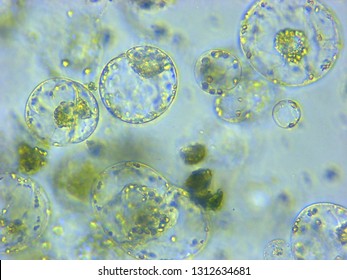 A photomicrograph of a plant protoplast cell isolated for use in a recent cutting-edge biotechnology CRISPR technology experiment.