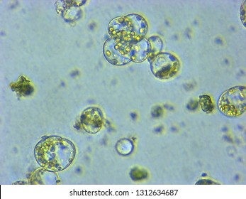 A Photomicrograph Of A Plant Protoplast Cell Isolated For Use In A Recent Cutting-edge Biotechnology CRISPR Technology Experiment.