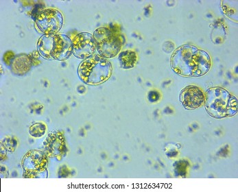 A Photomicrograph Of A Plant Protoplast Cell Isolated For Use In A Recent Cutting-edge Biotechnology CRISPR Technology Experiment.