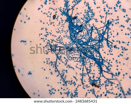 Photomicrograph showing Hyphae of dermatophytes, Nail scraping or skin scraping for fungus test in microbiology laboratory.