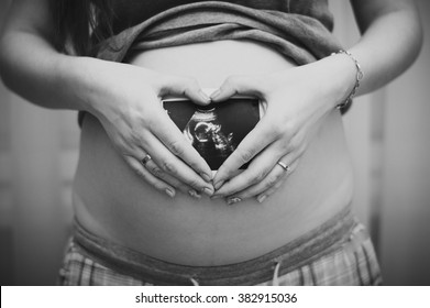 Photos of ultrasound on the mother's tummy