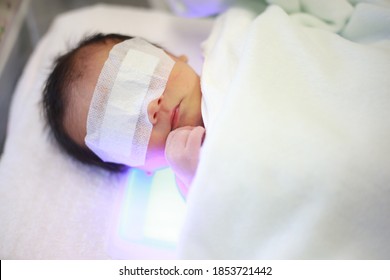 Phototherapy For Neonatal　Jaundice  Baby