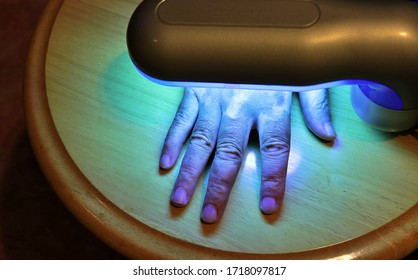 Phototherapy For Skin Diseases. Treatment Of Skin Diseases Such As Vitiligo, Psoriasis, And Eczema With Narrow-band Ultraviolet B.