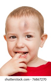 Physical Injury Blood Bruise On Wound Human Child