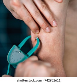 Physical Therapist Doing Skinfold Thickness Measurement