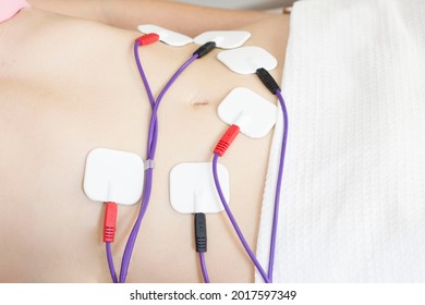 Physical therapy of the abdomen with the help of electrode pads, percutaneous electrical stimulation of the nerves. moistimulation, electrical stimulation, physiostimulation, myolifting.