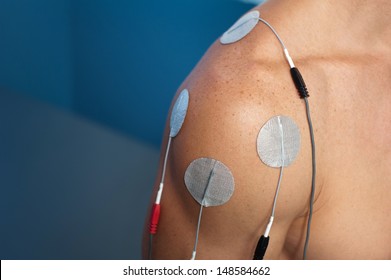 Physical therapy or chiropractic treatment of a male patient's injured shoulder using transcutaneous interferential electrical stimulation (TENS) for pain management.