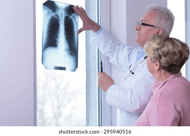 Physician Looking At Radiograph Of Woman With Healthy Lungs