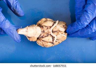 Physiology Student Dissecting A Cow Brain Diplaying The Underside Of The Organ With The Brainstem, Optical Nerves And Olfactory Tract