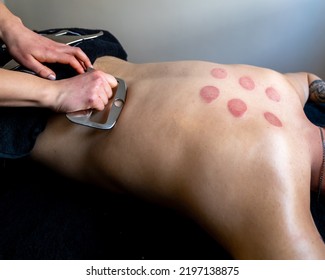 Physiotherapist Correcting Joint Pain Of Male Patient With IASTM Tool, Instrument Assisted Soft Tissue Mobilization Technique For Soft Tissue Treatment.