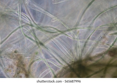 Phytoplankton Waste Water Under Microscope Stock Photo (Edit Now) 565687996