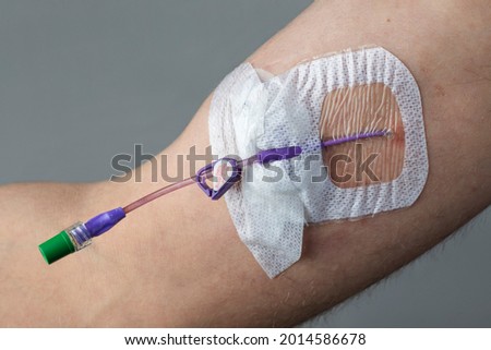 Picc (Peripherally Inserted Central Catheter) In The Arm Of A Man Stock foto © 