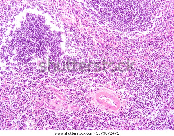 Picture Histology Human Spleen Tissue Microscope Stock Photo 1573072471 ...