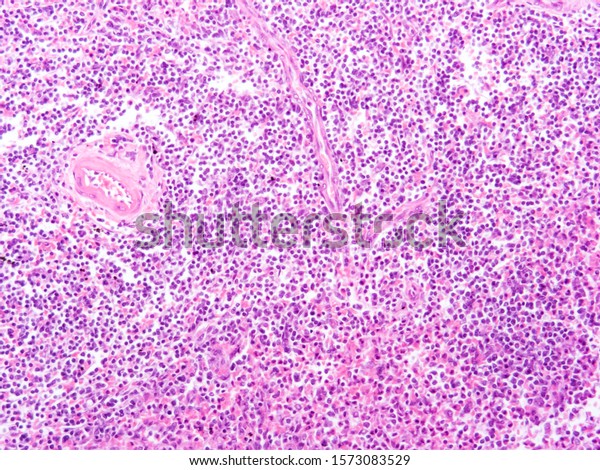 Picture Histology Human Spleen Tissue Microscope Stock Photo (Edit Now ...